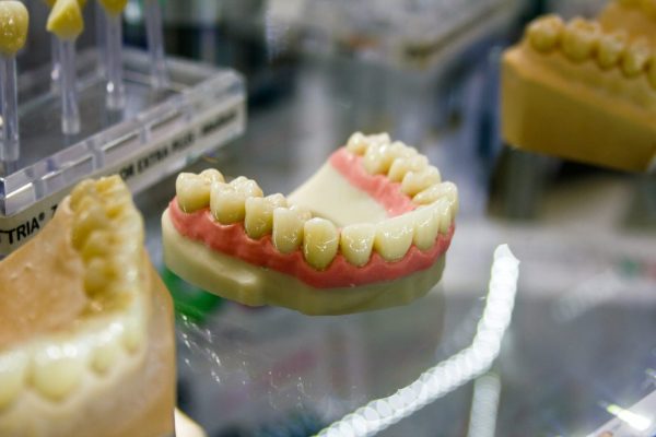 3D Printed Dental Models