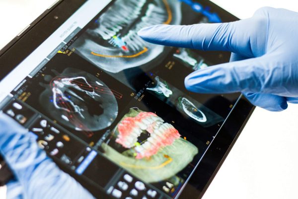 Digital Case Planning