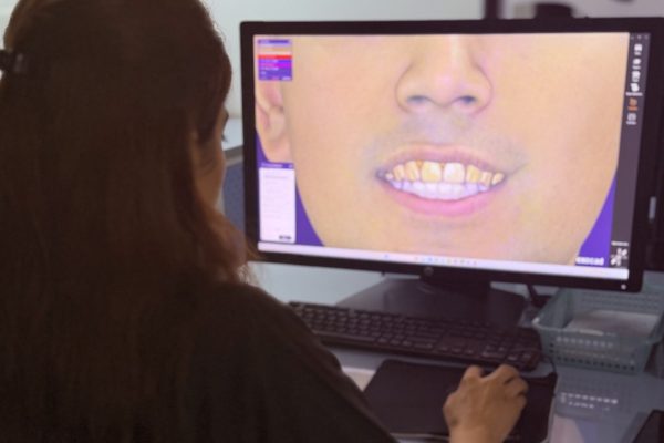 Digital Smile Design