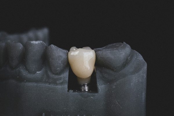 Zirconium crowns and bridges